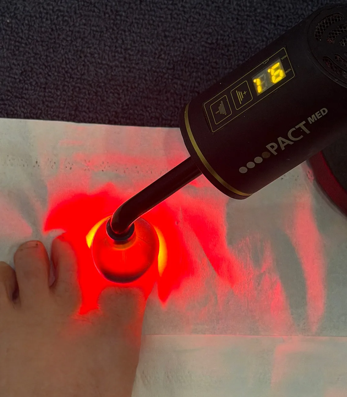 PACTMED red light treating a fungal toenail at Gladesville Healthcare